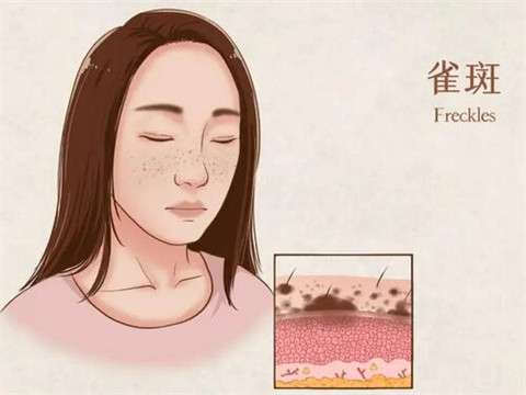 超皮秒VS调Q激光：哪种技术更适合你的肌肤问题