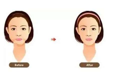 面部吸脂有效吗?多久可以看到效果